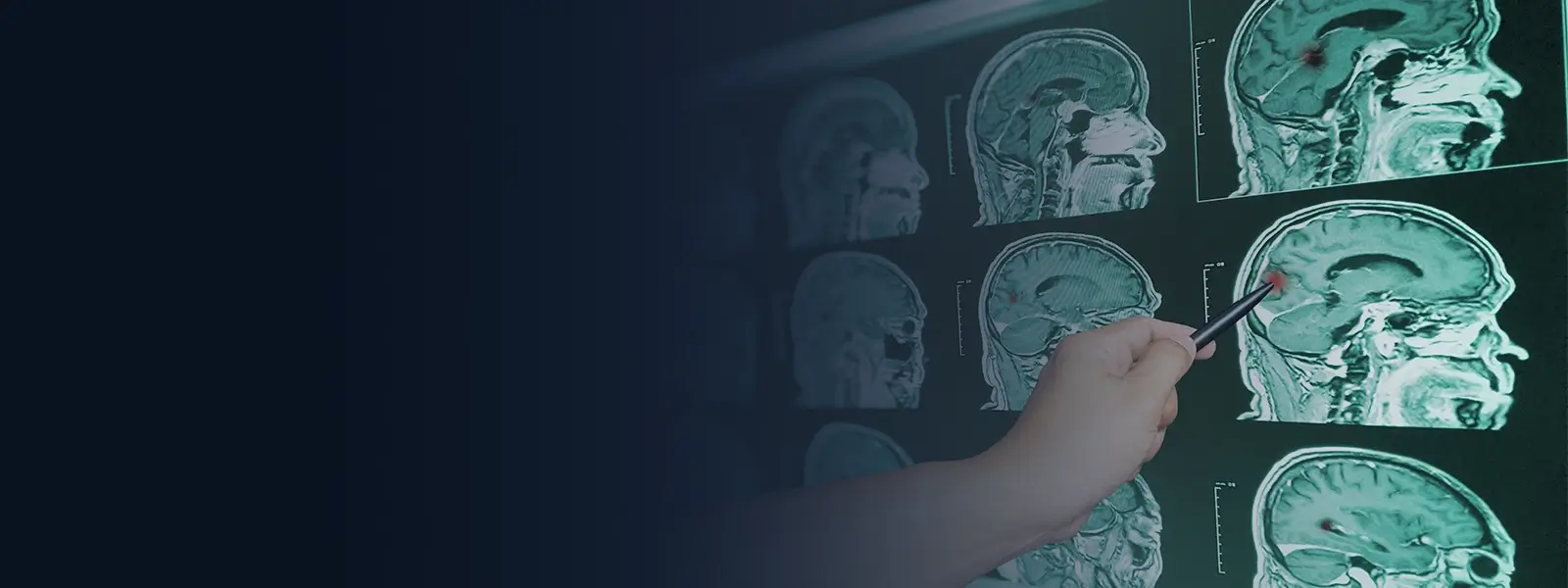 Acuerdos por Lesiones Traumáticas Cerebrales